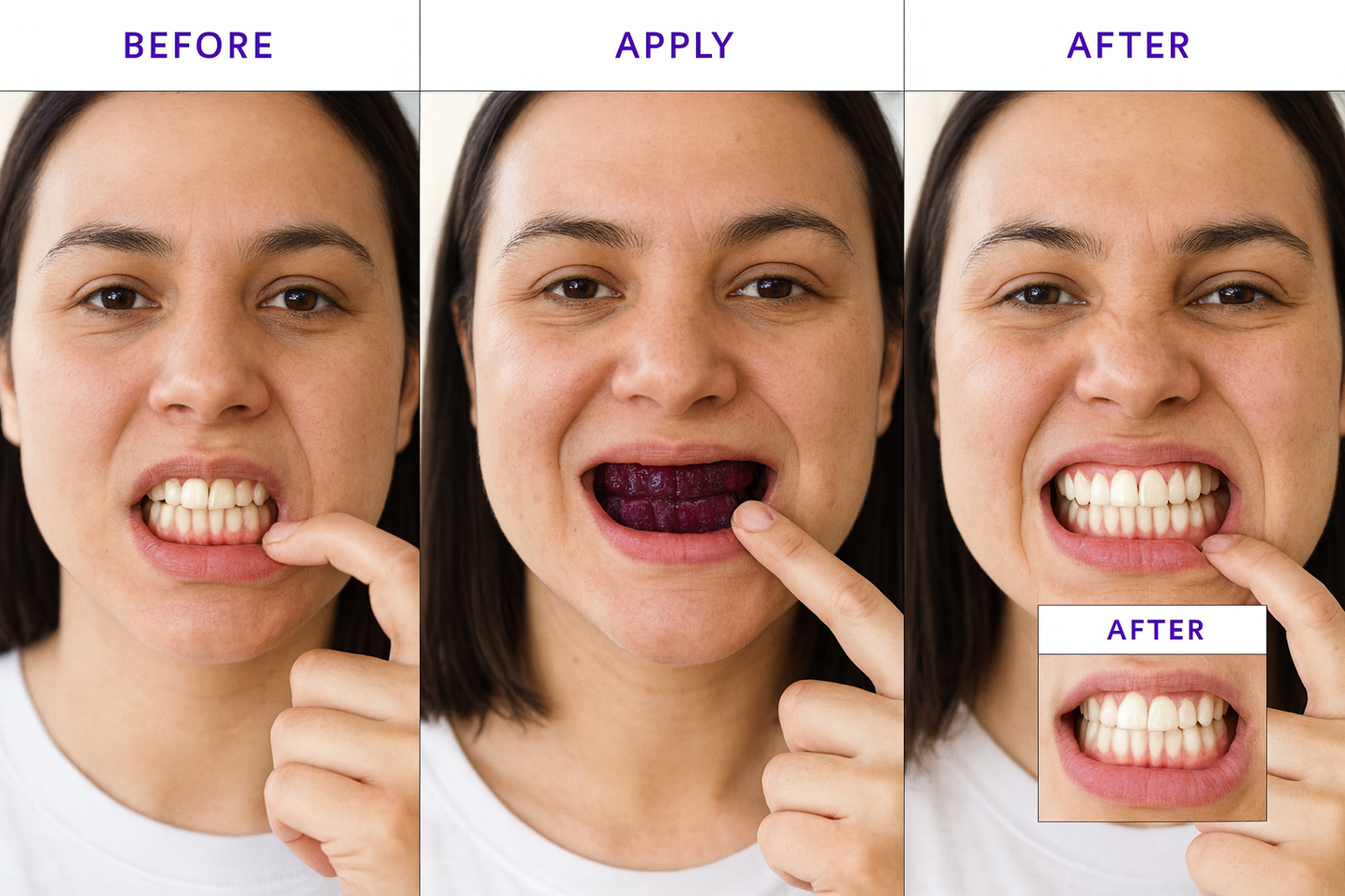PurpleCorrect™ V34 Whitening Strips