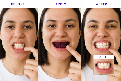 PurpleCorrect™ V34 Whitening Strips